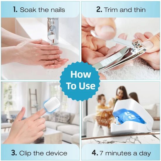 Imagen de Láser Para Hongos De Las Uñas. Antifúngico
